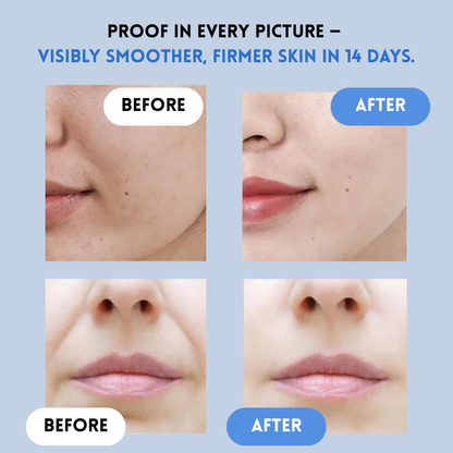 VarchePatch™ Wrinkle-Free Confidence