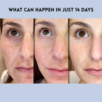 VarchePatch™ Wrinkle-Free Confidence