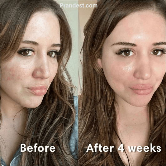 Varche™ Bio-Collagen Face mask