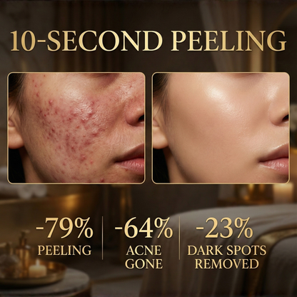 Varche™ - Révélez un teint parfait, éclatant de santé. 50 % de réduction