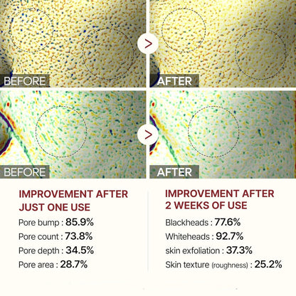 GlassSkin Pro™ - Obtenez une peau lisse et éclatante dès le lendemain matin (+ bonus mystère GRATUIT)