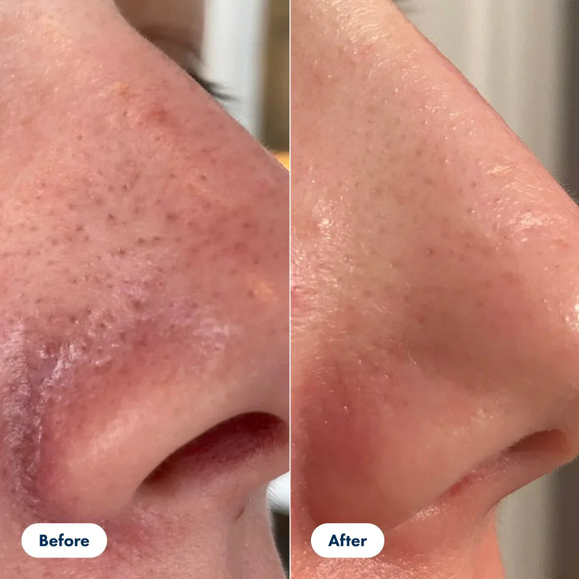 GlassSkin Pro™ - Obtenez une peau lisse et éclatante dès le lendemain matin (+ bonus mystère GRATUIT)