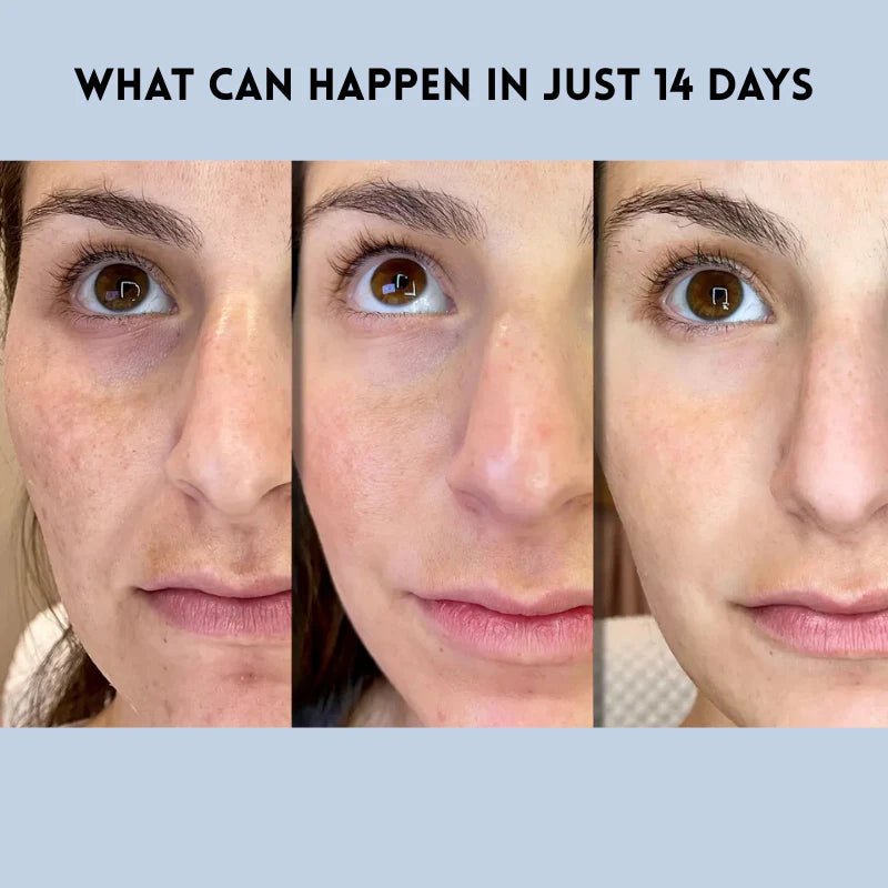 Varche™ — Rehaussez et hydratez instantanément votre peau grâce à une énergie de jeunesse 